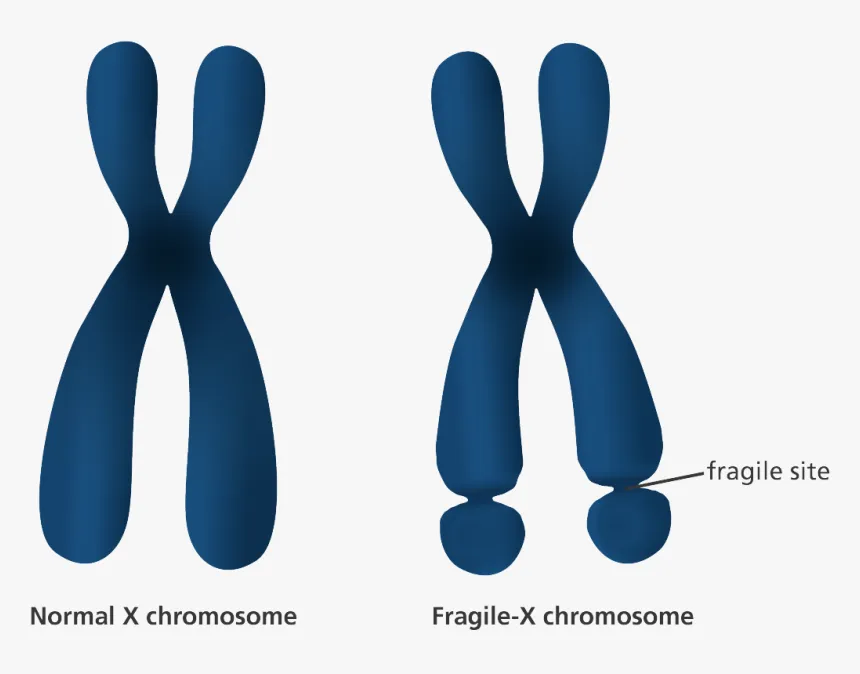 Blog Atom Feed 62 Fragile X syndrome - Causes of Disabilities